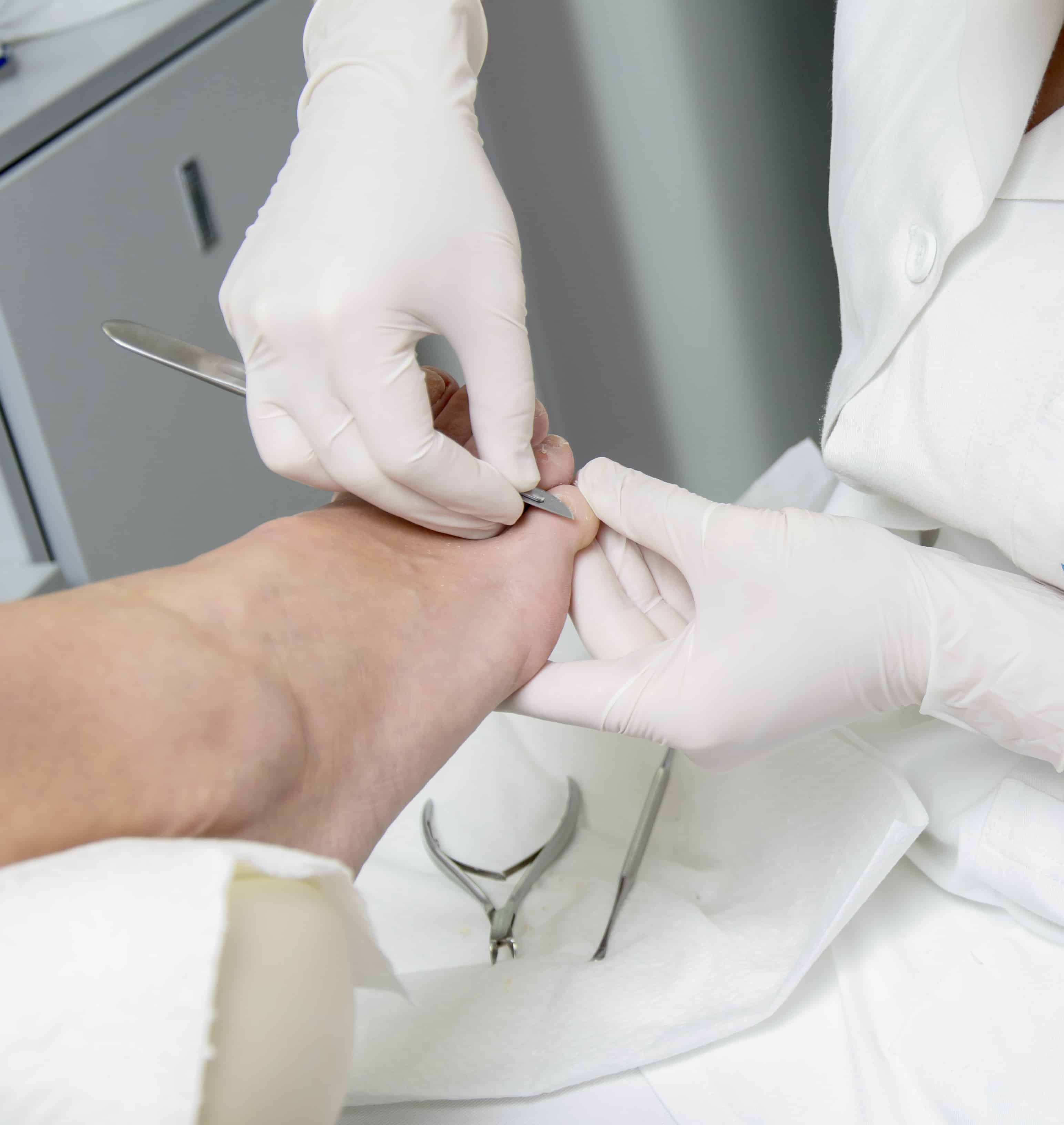 Pedicure treatment