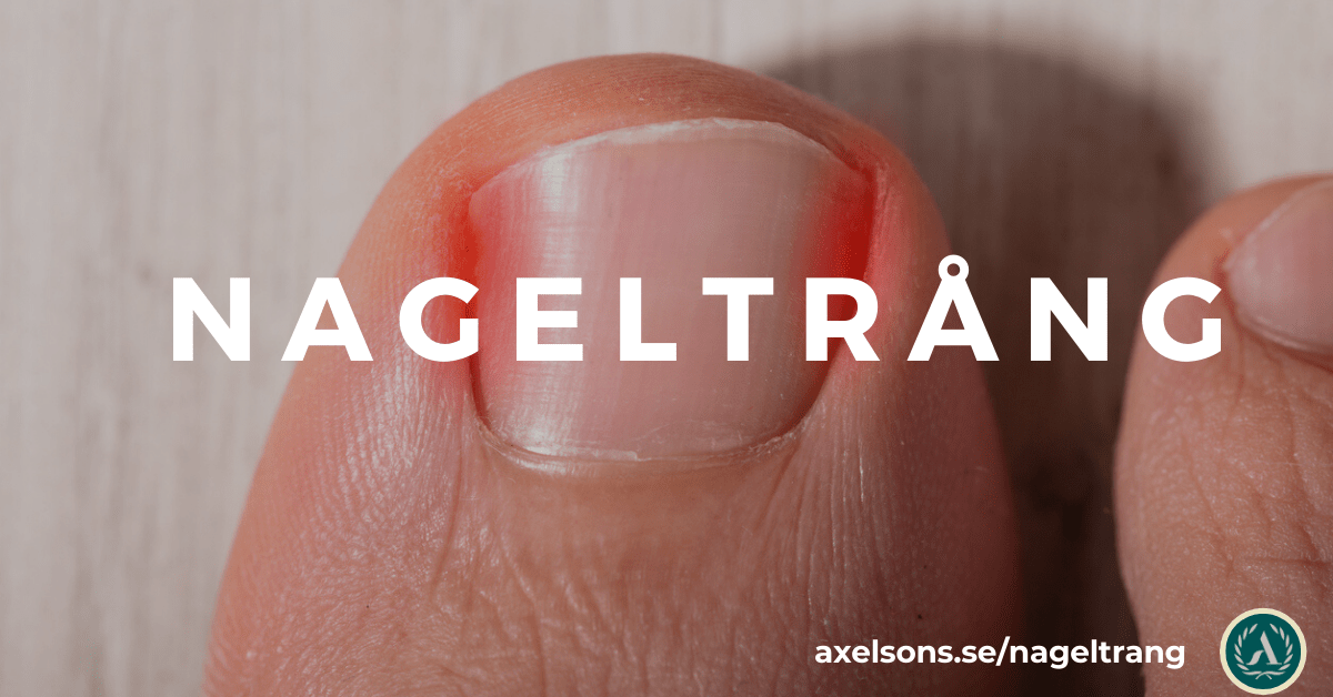 Nageltrång